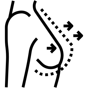 Tumore mammella